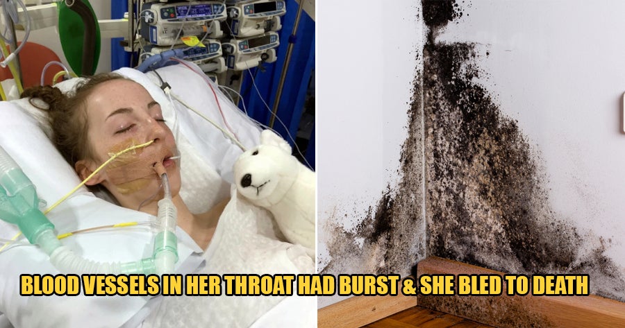 14Yo Dies After Breathing In Spores From Mould Which Ate Away The Inside Of Her Throat World Of Buzz 2