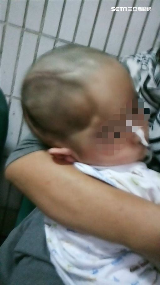 1Yo Baby Girl Paralysed For Life After Nanny Violently Abuses Her For Crying Non-Stop - World Of Buzz 2