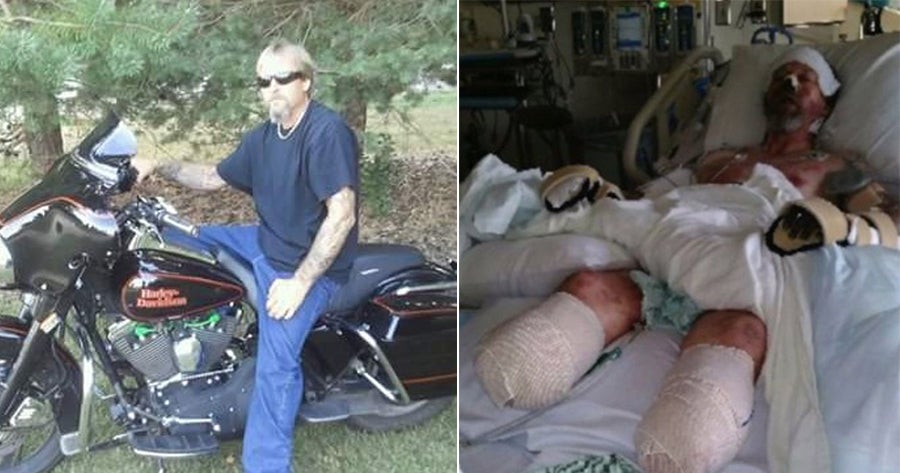 63yo Man Suffered Multiple Organ Failures and Died After His Pet Dog Licked Him - WORLD OF BUZZ 3