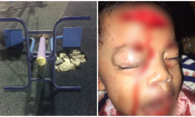 Little Boy Severely Injured After Exercise Station At Johor Playground Falls Onto Him - World Of Buzz