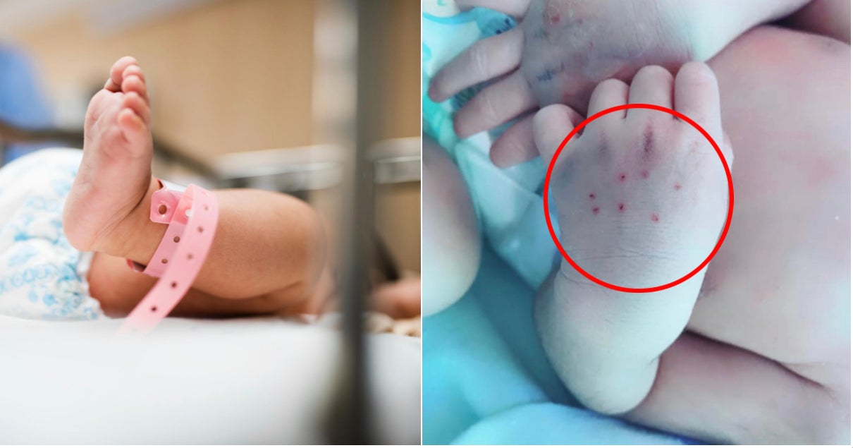 Baby’s Hands Suffered Bruises From 10 Jabs Done By Trainee Doctor To Draw Blood - World Of Buzz 3