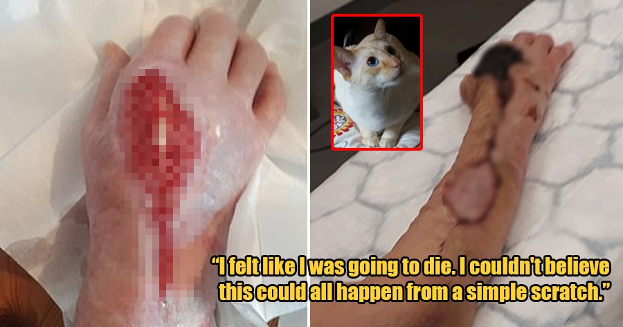 Deep Cat Scratch Turned Into A Deadly Flesh-Eating Disease Which Almost Kills 65Yo Woman - World Of Buzz