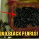Doctor Finds Over 1,000 'Black Pearls' In 60Yo Man'S Gall Bladder After He Complained Of Stomach Ache - World Of Buzz 1