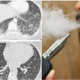 First Alleged Case Of Vape Related Illness Has Surfaced In Malaysia, Teen Suffers Serious Lung Injuries - World Of Buzz 2