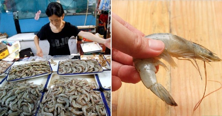 Man Accidentally Cuts Finger While Handling Prawns, Gets Deadly Infection & Dies 3 Days Later - WORLD OF BUZZ 3