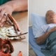 Man Eats Leftover Seafood That He Kept Overnight, Almost Dies From Deadly Infection - World Of Buzz 2