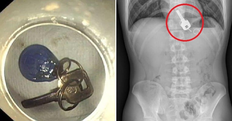 man gets so drunk he lost his keys turns out he swallowed them instead world of buzz 3