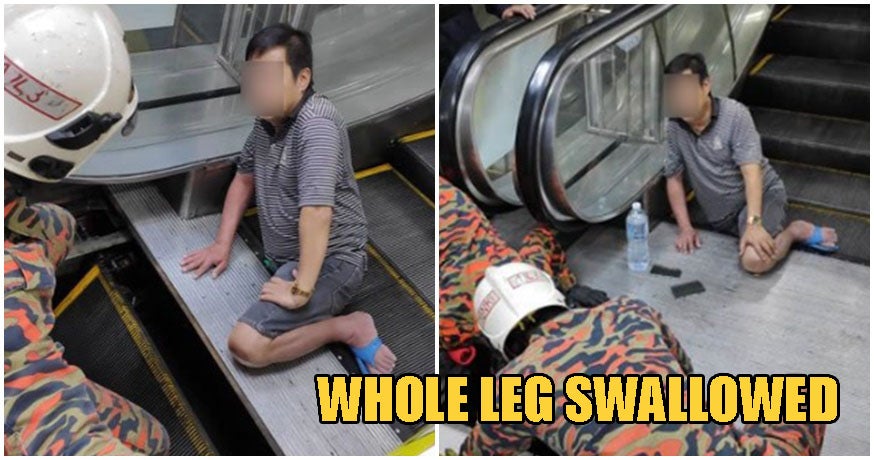 Man Wearing Slippers Gets His Whole Right Leg Swallowed By Escalator At Kl Shopping Mall - World Of Buzz