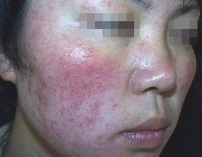 M'sian Lady Warns About Buying Fake & Cheap Skincare Products Online As It Can Ruin Your Face - WORLD OF BUZZ 2