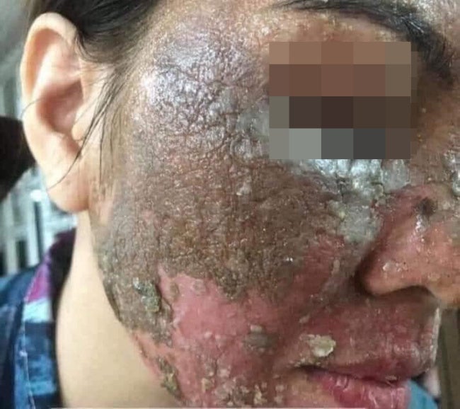 M'sian Lady Warns About Buying Fake & Cheap Skincare Products Online As It Can Ruin Your Face - WORLD OF BUZZ 3
