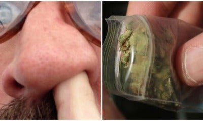 Australian Man Had Weed Packet Stuck In Nose For 18 Years, Said He Forgot About It - World Of Buzz