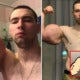 23Yo Injects 3 Litres Of Petroleum Jelly Into Muscles To Bulk Up Biceps &Amp; Triceps Like Popeye The Sailor Man - World Of Buzz