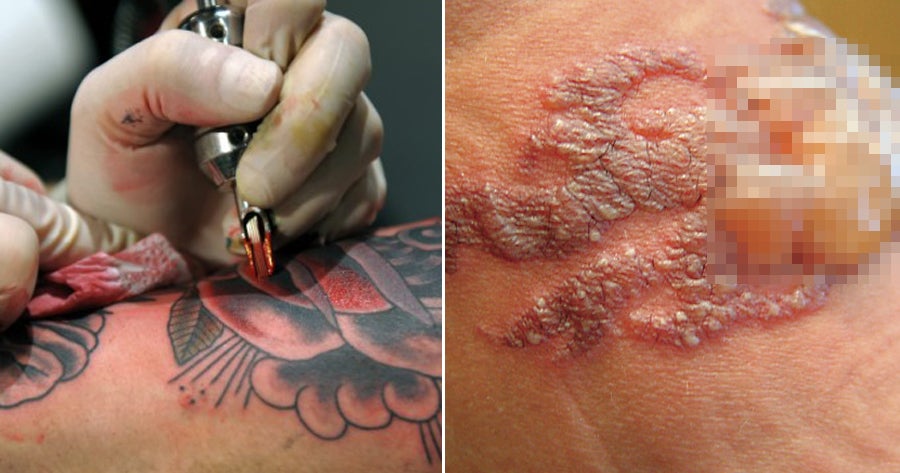 study bright coloured tattoos may leak heavy metals into your body causing allergic reactions world of buzz