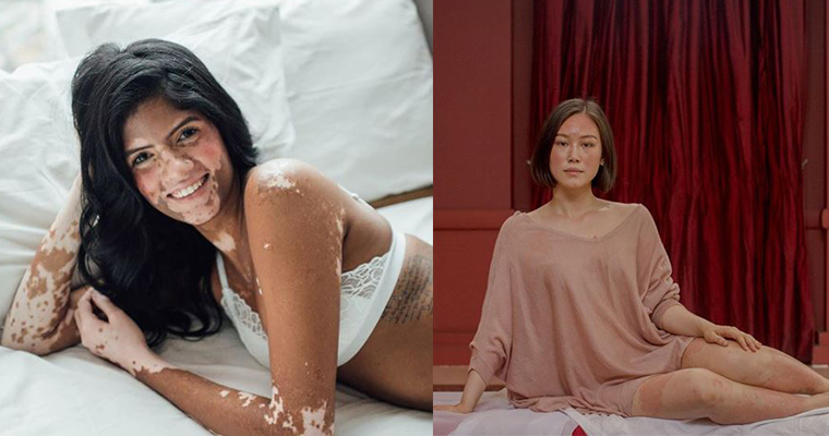 This Exhibition By Malaysian Photographers Is All About Self-Love - World Of Buzz 1