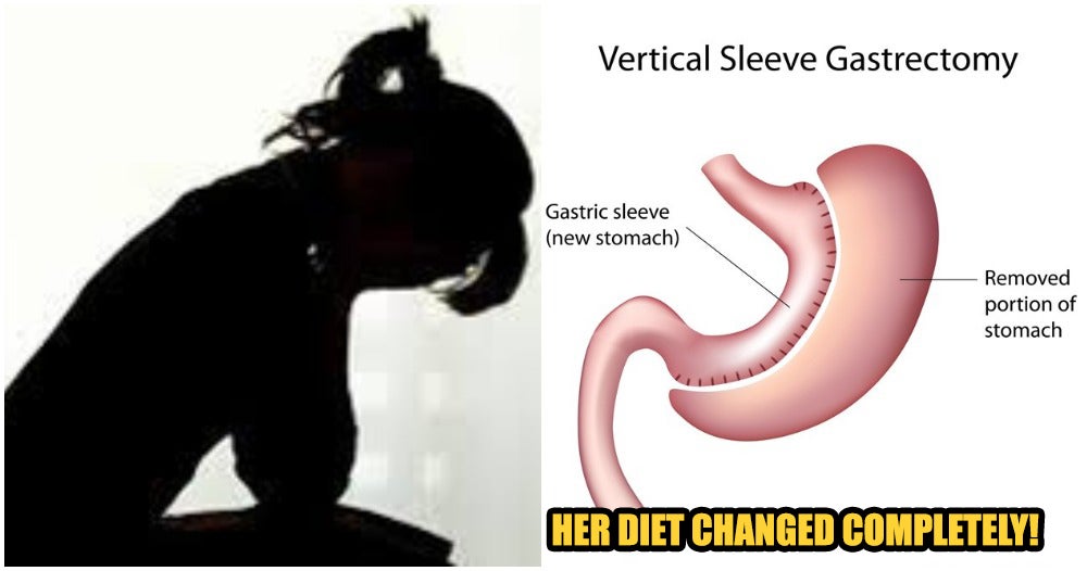 woman removed her whole stomach after discovering genetic mutation in gene world of buzz 1