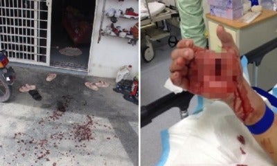 18Yo Perak Boy Gets Slashed After Fighting 2 Bold Robbers Who Woke Him Up By Turning On The Lights - World Of Buzz 3