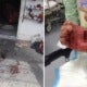 18Yo Perak Boy Gets Slashed After Fighting 2 Bold Robbers Who Woke Him Up By Turning On The Lights - World Of Buzz 3