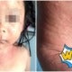 5Yo Girl Suffers Painful Chlorine Burns After Swimming In Freshly Cleaned Swimming Pool - World Of Buzz