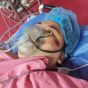 Girl Fell Off A Flyover In Bangsar, Now Critical - WORLD OF BUZZ 3