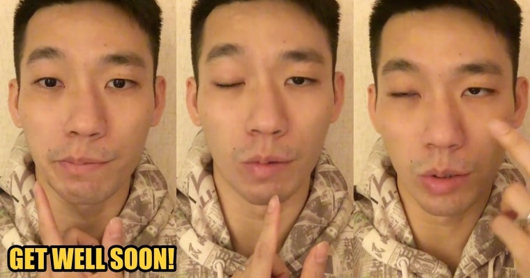 M'Sian Badminton Player Chan Peng Soon Suffers From Bell Palsy, Half Of His Face Is Paralysed - World Of Buzz 2