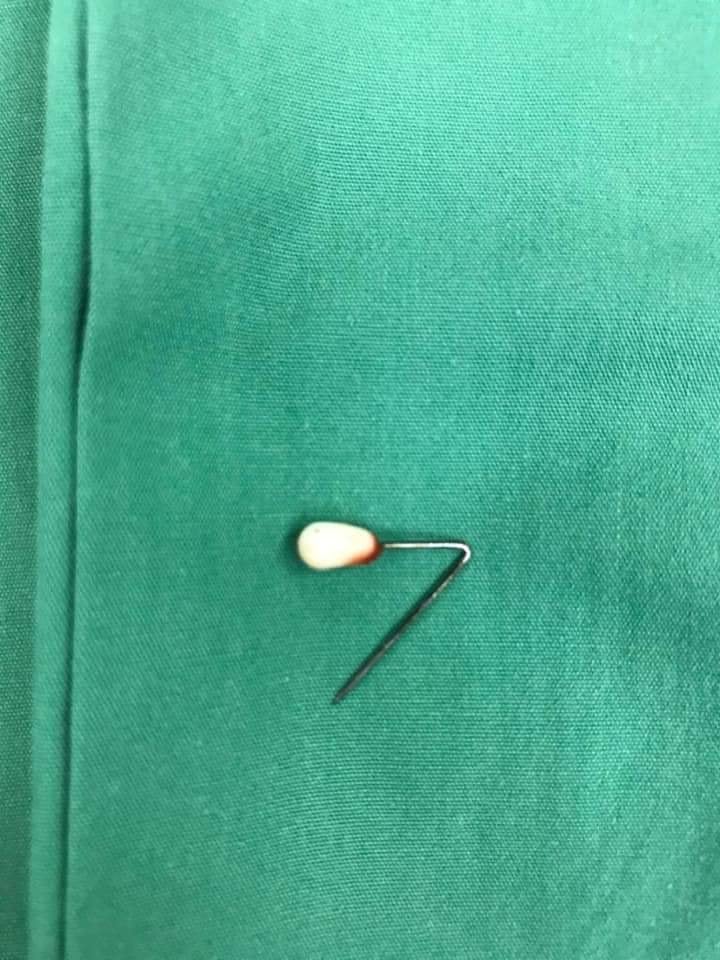 M'sian Women Had A Headscarf Pin Stuck In Her Lung - WORLD OF BUZZ 5