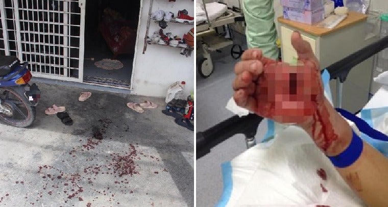 20yo Penang Teacher Robbed and Stabbed 9 Times in The Back by Her Ex-Neighbour - WORLD OF BUZZ 3