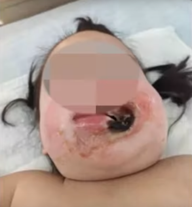 2Yo Girl Suffers 4Th Degree Burns After Negligent Mother Didn't Notice Her Playing With Electric Sockets - World Of Buzz 1