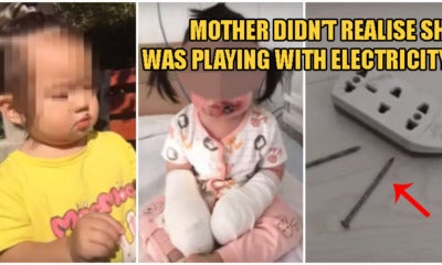 2Yo Girl Suffers 4Th Degree Burns After Negligent Mother Didn'T Notice Her Playing With Electric Sockets - World Of Buzz 3