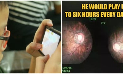 5Yo'S Eye Power Is Almost 1,000 Degrees After Playing Video Games Daily For 2 Years! - World Of Buzz 1