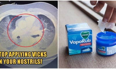 Applying Vicks On Your Nostrils Can Lead To Respiratory Complications, Says Doctor - World Of Buzz 3