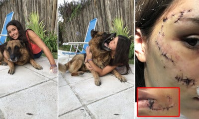 17Yo Girl Suffers 40 Stitches On Face &Amp; Gums After Dog Attacked Her While Taking A Photo - World Of Buzz
