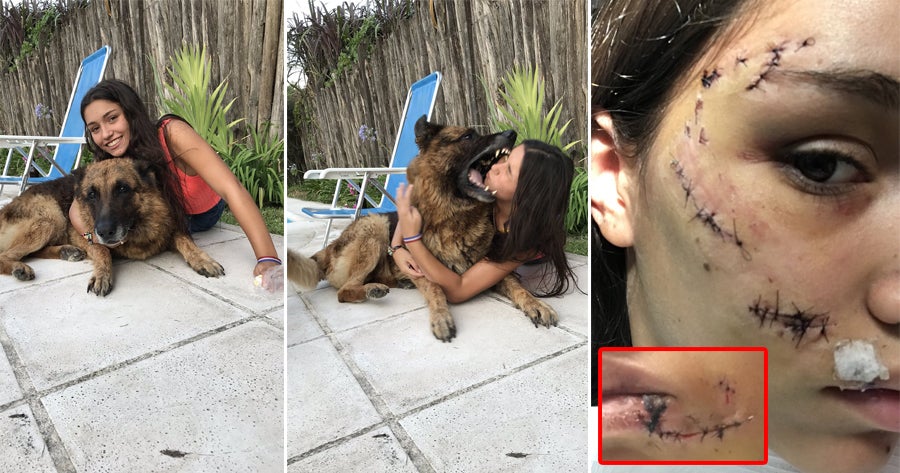 17Yo Girl Suffers 40 Stitches On Face &Amp; Gums After Dog Attacked Her While Taking A Photo - World Of Buzz