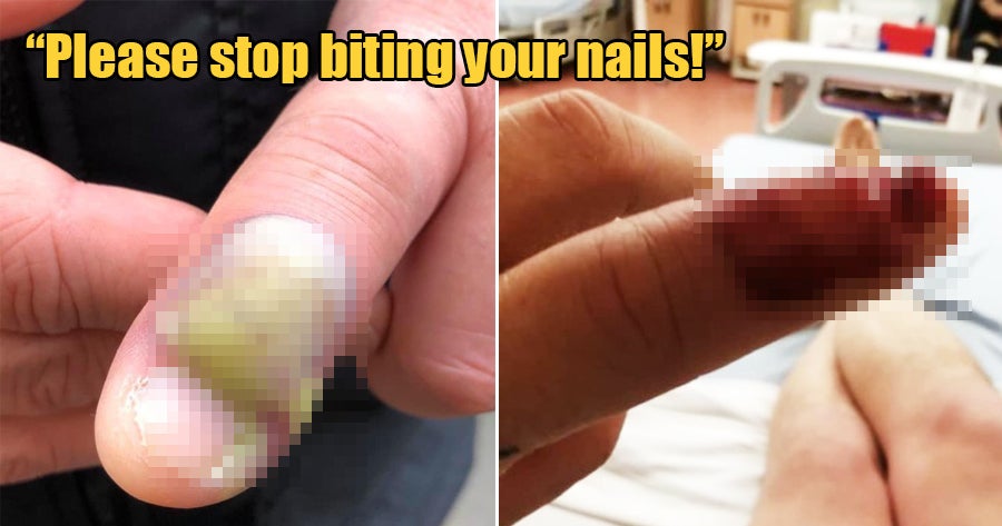 What Happens When You Eat Nail Polish? – ORLY