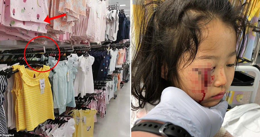 6Yo Girl'S Top Eyelid Sliced Off By Metal Hook After Jumping To Reach A Shirt She Wanted - World Of Buzz
