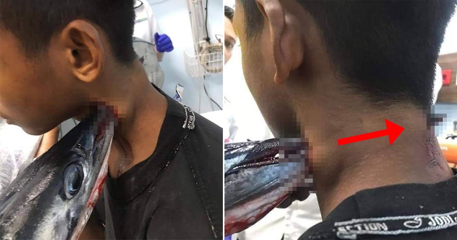 Teenager Gets Stabbed In The Neck By Swordfish While Fishing With His Paren - World Of Buzz