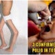 Warning: 2 More Cases Of Polio Have Been Confirmed In Sabah According To Moh - World Of Buzz