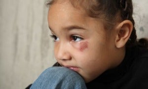 5 Year Old Boy In Terengganu With Broken Cheekbone, Believed To Have Been Abused At Home - World Of Buzz