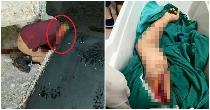 51Yo Penang Man'S Arm Gets Horrifically Ripped Off While Moving Heavy Machinery At Paper Mill - World Of Buzz 4