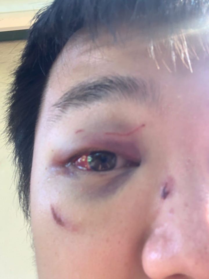 Chinese Fencing Student Got A Beating From Locals For Using A Foreign Language In Adelaide - WORLD OF BUZZ