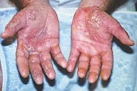 Doctors Hands Turn Red &Amp; Swollen From Working On Wuhan Cure For 12 Hours In Lab Everyday - World Of Buzz 2