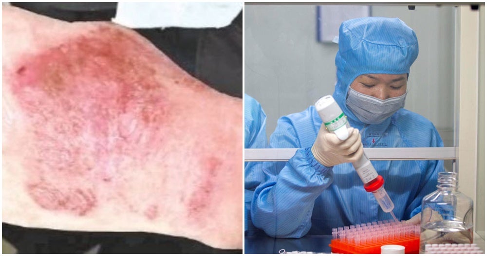 Doctors Hands Turn Red &Amp; Swollen From Working On Wuhan Cure For 12 Hours In Lab Everyday - World Of Buzz 3