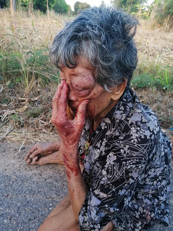 Drunk Grandson Violently Abuses His Grandmother, Forcing Her To Run From Home & Sleep On Streets - WORLD OF BUZZ 2