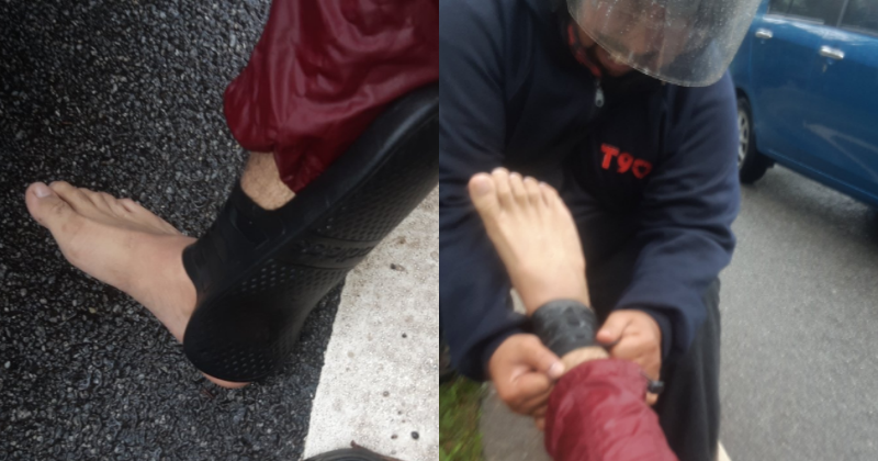 Motorcyclist Shares His Story Of Getting Into An Accident, Wonders How His Slipper Turned Into An Anklet - World Of Buzz 4