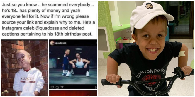 People Are Claiming 9Yo Bullied For Dwarfism Is Faking His Age But Multiple Evidence Proves Otherwise - World Of Buzz