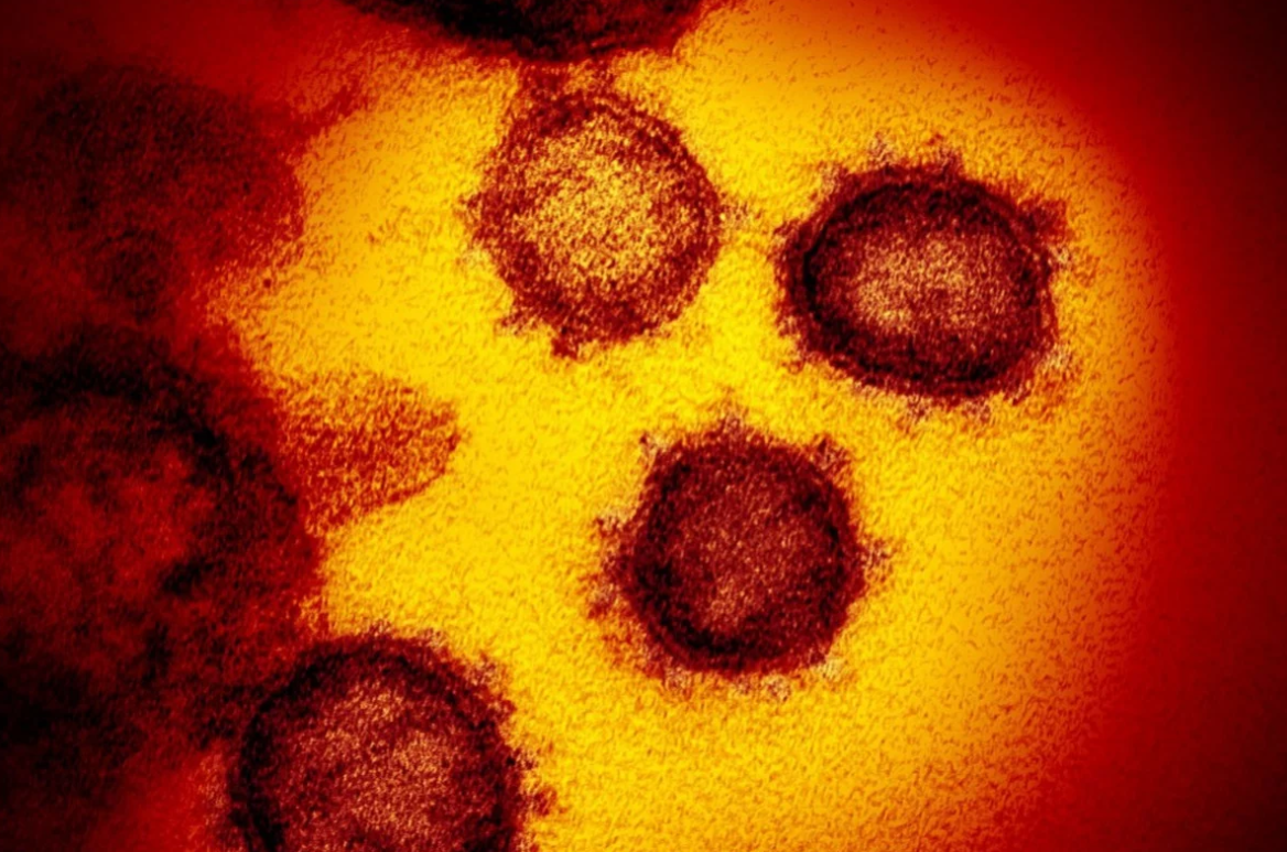 Researchers: Coronavirus May Be 20 Times More Likely To Bind To Human Cells Than Sars - World Of Buzz