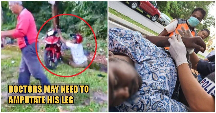 Selayang Snatch Thief Gets Instant Karma, Loses His Leg After Snatching Woman's Handbag - WORLD OF BUZZ 3