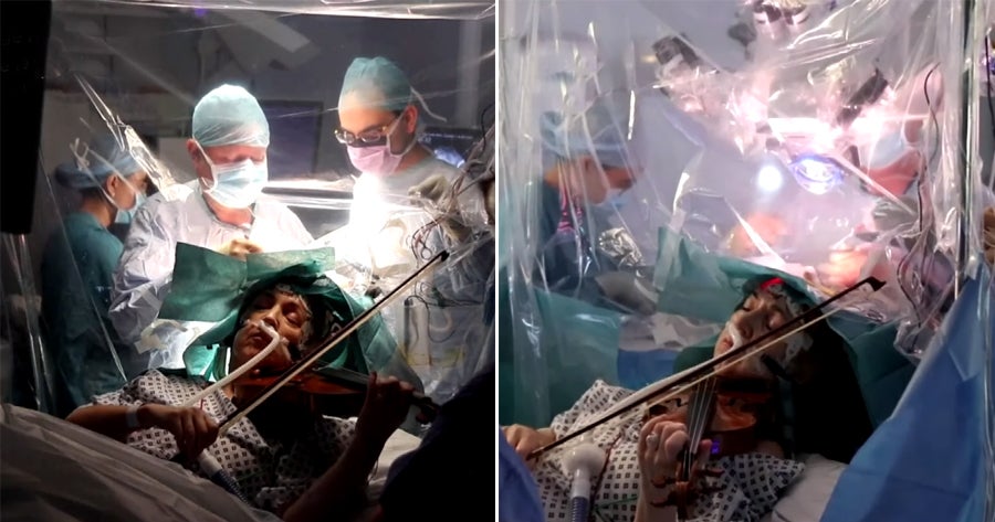 53Yo Woman With Brain Tumour Plays Violin During Surgery To Prevent Damage To Motor Skills - World Of Buzz