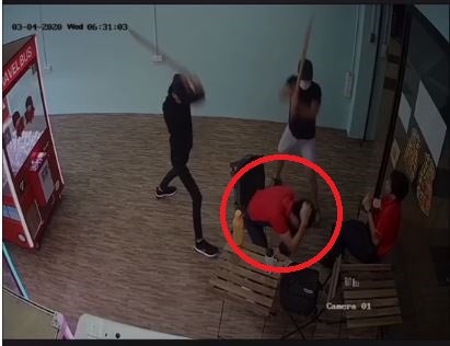 17yo Johor Boy Gets Beaten Up By Bullies For 'Offending' School Seniors, Hospitalised With Back Injuries - WORLD OF BUZZ 2