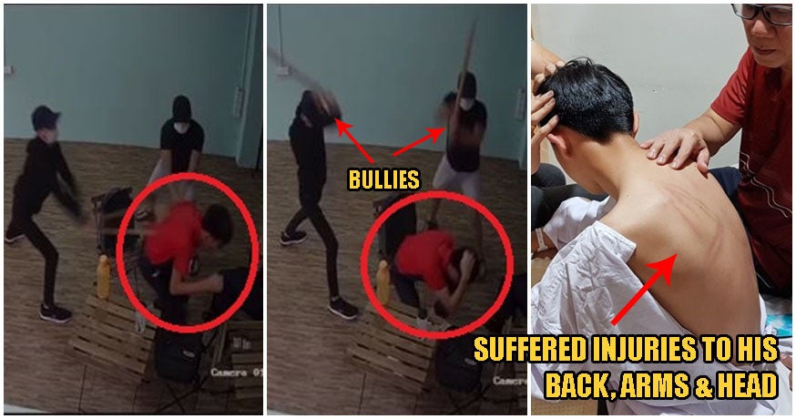 17Yo Johor Boy Gets Beaten Up By Bullies For 'Offending' School Seniors, Hospitalised With Back Injuries - World Of Buzz 5