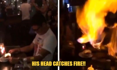 Watthis Boy'S Head Catches Fire On His Birthday When His Friends Spray Aerosol Party Spray At Him - World Of Buzz